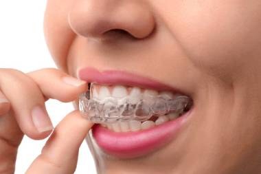 Invisalign clear aligner provider in Mahalunge