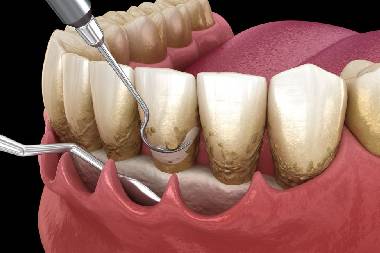 General Dentistry in Mahalunge