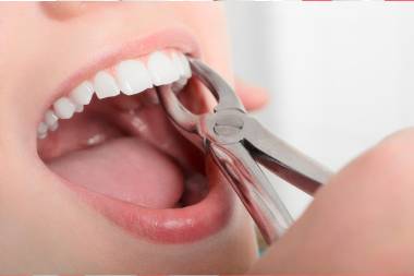 Best dental implant services in Mahalunge
