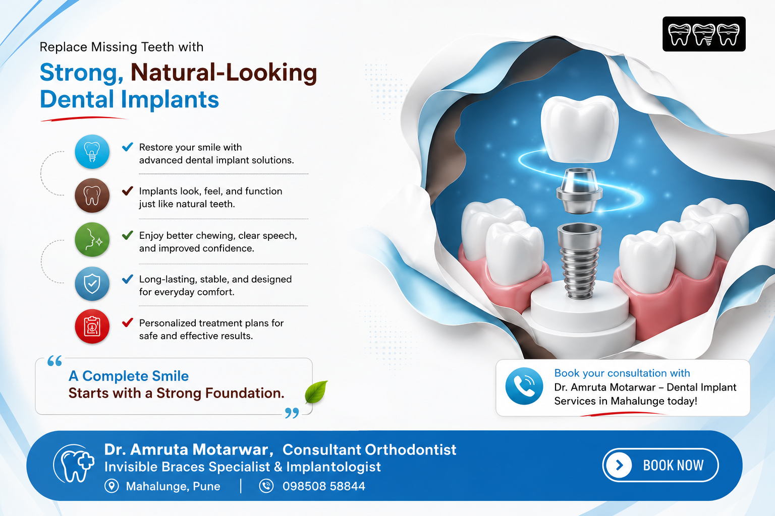 Best dental implant services in Mahalunge